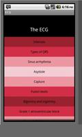 Electrocardiogram ECG Types