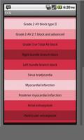 Electrocardiogram ECG Types