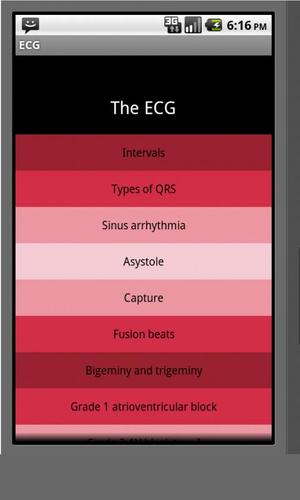 Electrocardiogram ECG Types