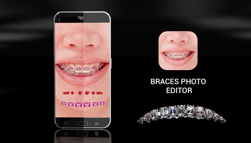 Braces Photo Editor