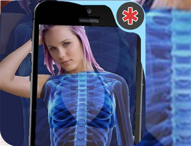 Xray Camera Scanner